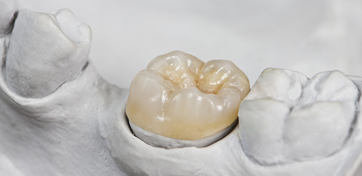 Severe periodontal treatment