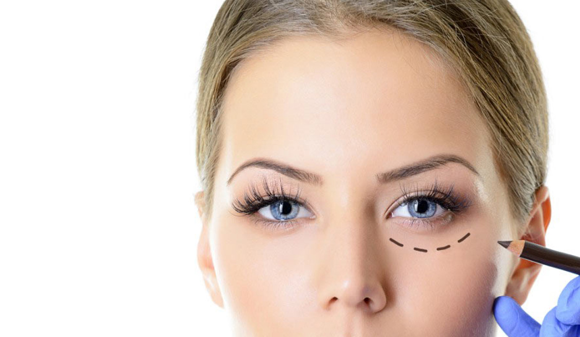 Lower Eyelids<br> Facial Fat Grafting