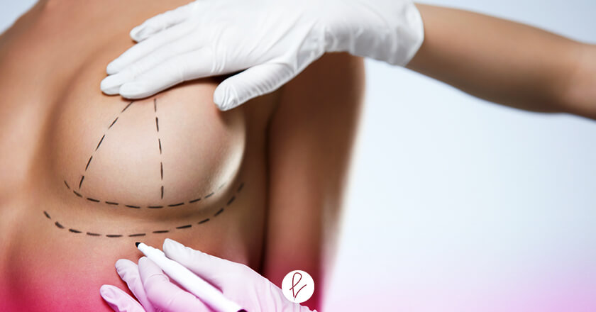 Breast Surgery