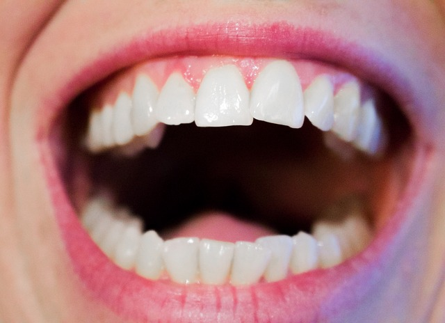 Moderate periodontal treatment