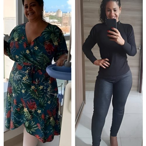 bariatric-1 (1)