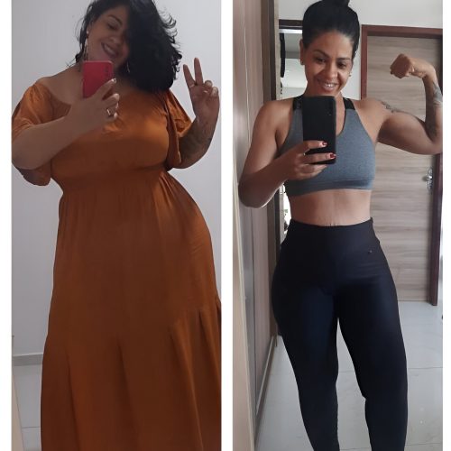 bariatric-2 (1)