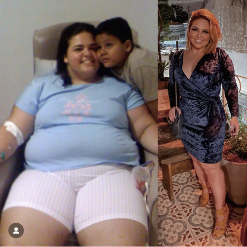 bariatric-5