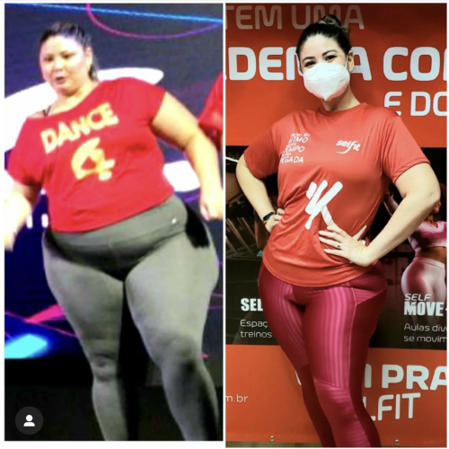 bariatric-6